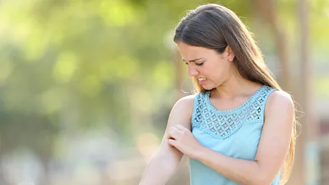 Alamy People can react in very different ways to mosquito bites (Credit: Alamy)